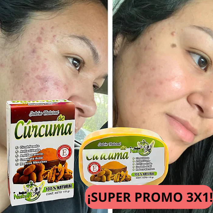 3x1 JABONES DE CURCUMA ¡SUPER VIRALES!