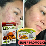3x1 JABONES DE CURCUMA ¡SUPER VIRALES!
