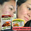 3x1 JABONES DE CURCUMA ¡SUPER VIRALES!