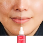 Serum ANUA LuminaTX™⭐