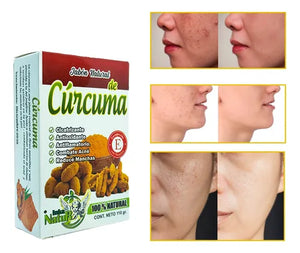 3x1 JABONES DE CURCUMA ¡SUPER VIRALES!