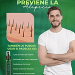 OUHOE-✨ Recupera tu Cabello en Semanas- Tratamiento Capilar