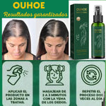OUHOE-✨ Recupera tu Cabello en Semanas- Tratamiento Capilar